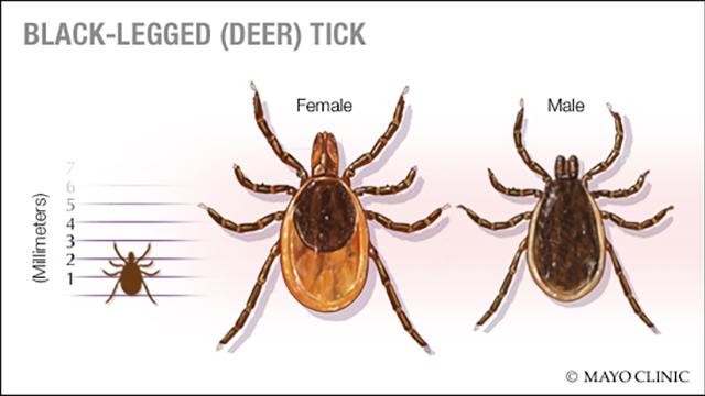 Mayo Clinic Q and A Protecting yourself from Lyme disease