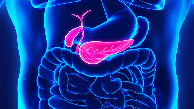 What you should know about pancreatic cancer